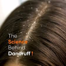 The Science Behind Dandruff