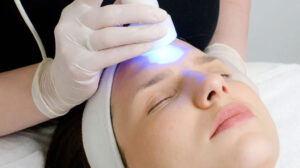Best Acne Scar Removal Treatments