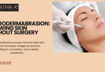 Microdermabrasion: Get Youthful, Glowing Skin Without Surgery