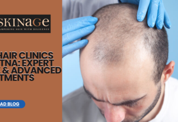 Top Hair Clinics in Patna: Expert Care & Advanced Treatments