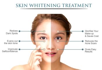 Skin whitening in Patna