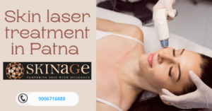 Laser Treatments in Patna