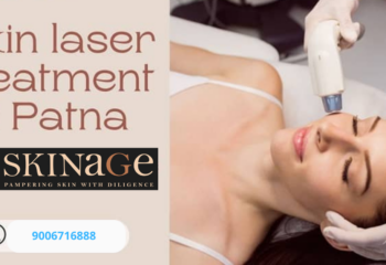 Best Laser Treatments in Patna for Skin & Hair Issues